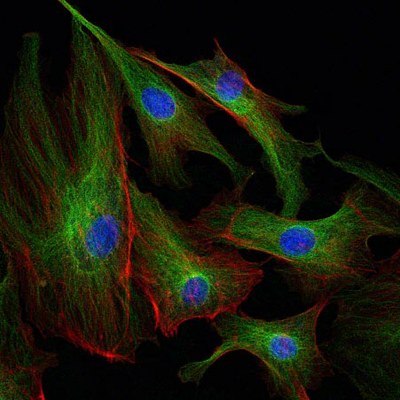 Test Cells